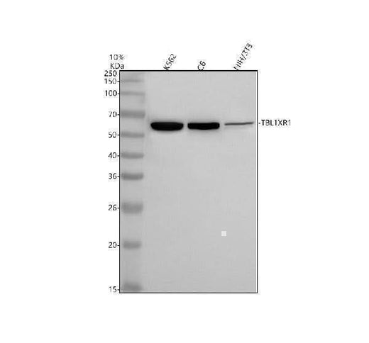Anti-TBLR1 Rabbit Monoclonal Antibody Boster Bio