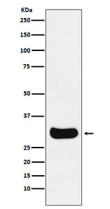 Anti-Gemin 2 Rabbit Monoclonal Antibody Boster Bio