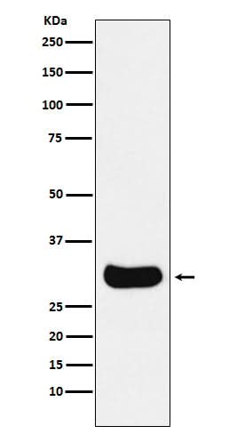 Anti-Gemin 2 Rabbit Monoclonal Antibody Boster Bio