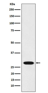 Anti-RCHY1 Rabbit Monoclonal Antibody Boster Bio