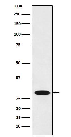 Anti-RCHY1 Rabbit Monoclonal Antibody Boster Bio