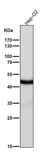 Anti-Cyclin E2 CCNE2 Rabbit Monoclonal Antibody Boster Bio