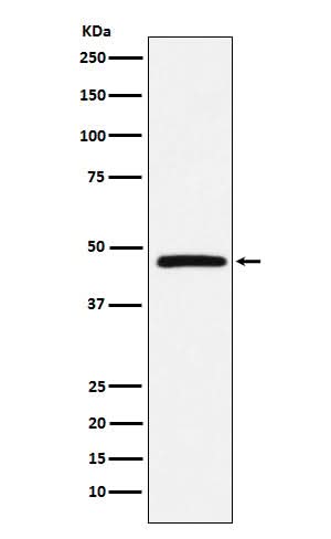 Anti-DARC Rabbit Monoclonal Antibody Boster Bio