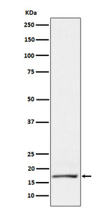 Anti-GCDFP 15 Rabbit Monoclonal Antibody Boster Bio