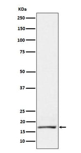 Anti-GCDFP 15 Rabbit Monoclonal Antibody Boster Bio