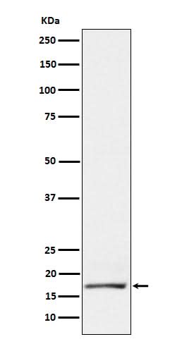 Anti-GCDFP 15 Rabbit Monoclonal Antibody Boster Bio