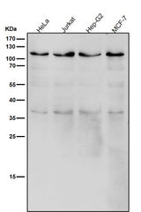 Anti-USP5 Rabbit Monoclonal Antibody Boster Bio