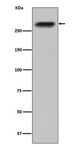 Anti-CENPE Monoclonal Antibody Boster Bio