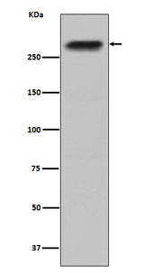Anti-CENPE Monoclonal Antibody Boster Bio