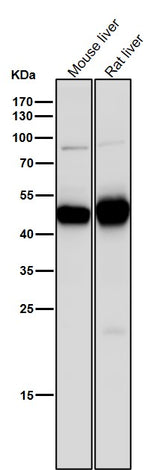 Anti-MAT2A Rabbit Monoclonal Antibody Boster Bio