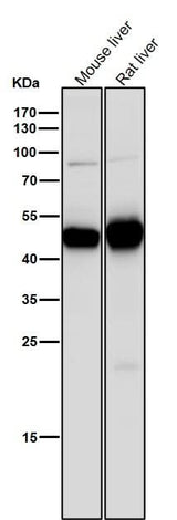 Anti-MAT2A Rabbit Monoclonal Antibody Boster Bio