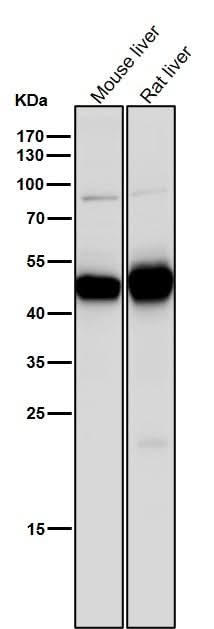 Anti-MAT2A Rabbit Monoclonal Antibody Boster Bio