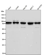 Anti-Apc6 / CDC16 Rabbit Monoclonal Antibody Boster Bio