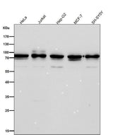 Anti-Apc6 / CDC16 Rabbit Monoclonal Antibody Boster Bio