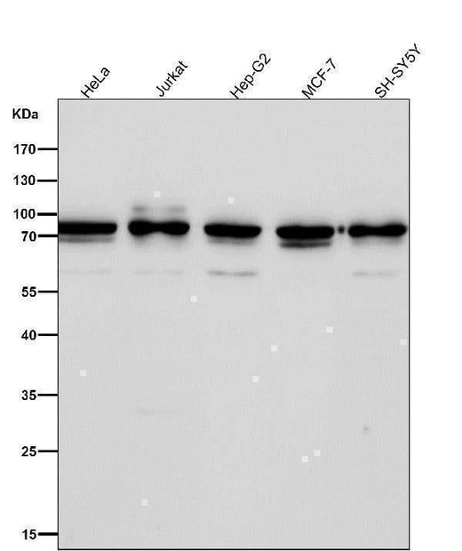 Anti-Apc6 / CDC16 Rabbit Monoclonal Antibody Boster Bio