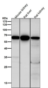 Anti-Cdc16/APC6 Rabbit Monoclonal Antibody Boster Bio