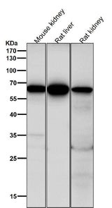 Anti-Cdc16/APC6 Rabbit Monoclonal Antibody Boster Bio