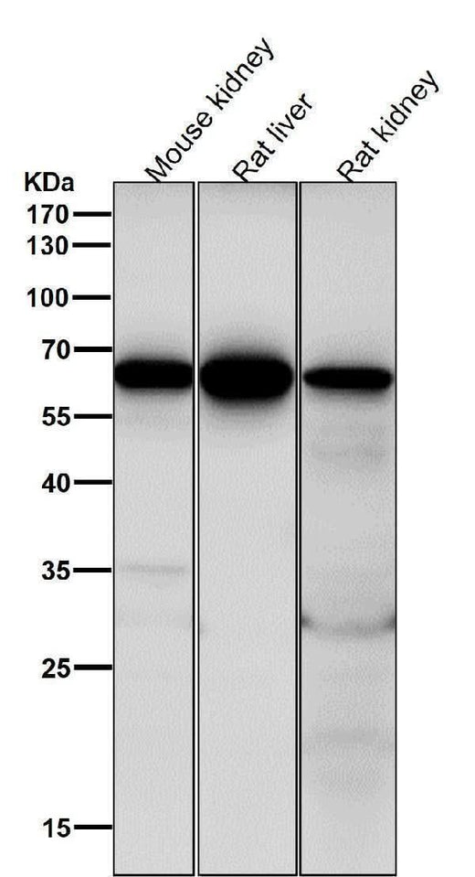 Anti-Cdc16/APC6 Rabbit Monoclonal Antibody Boster Bio