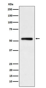 Anti-Human IgG1 Rabbit Monoclonal Antibody Boster Bio