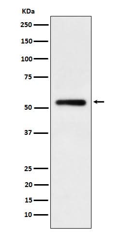 Anti-Human IgG1 Rabbit Monoclonal Antibody Boster Bio