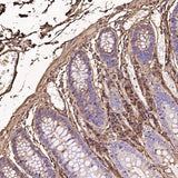 Anti-Human IgG IGHG1 Rabbit Monoclonal Antibody Boster Bio