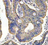 Anti-Thioredoxin 2 Monoclonal Antibody Boster Bio