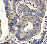 Anti-Thioredoxin 2 Monoclonal Antibody Boster Bio
