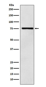 Anti-DCP1A Monoclonal Antibody Boster Bio