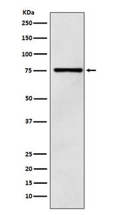 Anti-DCP1A Monoclonal Antibody Boster Bio