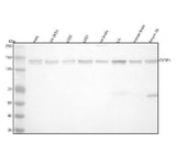 Anti-CYFIP1 Rabbit Monoclonal Antibody Boster Bio