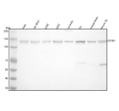 Anti-CYFIP1 Rabbit Monoclonal Antibody Boster Bio