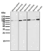 Anti-ALDH1L1 Rabbit Monoclonal Antibody Boster Bio
