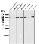 Anti-ALDH1L1 Rabbit Monoclonal Antibody Boster Bio