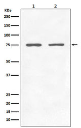 Anti-GARS Rabbit Monoclonal Antibody Boster Bio