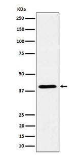 Anti-ADH4 Rabbit Monoclonal Antibody Boster Bio