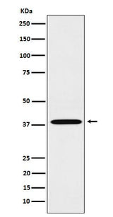 Anti-LTB4R Rabbit Monoclonal Antibody Boster Bio