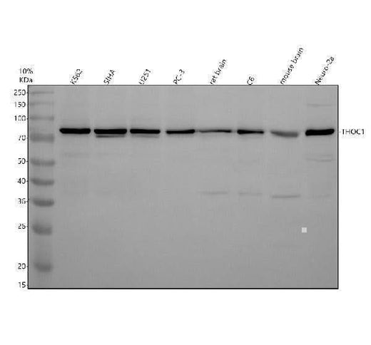 Anti-Nuclear Matrix Protein p84 Monoclonal Antibody Boster Bio