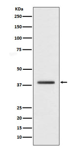 Anti-macroH2A.1 H2AFY Monoclonal Antibody Boster Bio