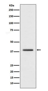 Anti-macroH2A.1 H2AFY Monoclonal Antibody Boster Bio