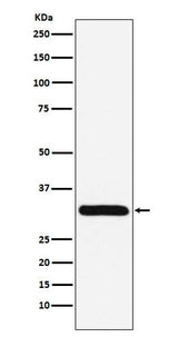 Anti-PSME1 Rabbit Monoclonal Antibody Boster Bio