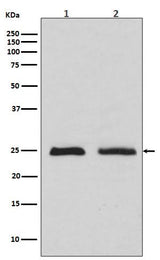 Anti-Rab4 RAB4A Rabbit Monoclonal Antibody Boster Bio
