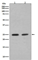 Anti-Rab4A/Rab4 Rabbit Monoclonal Antibody Boster Bio