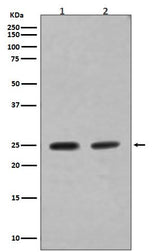 Anti-Rab4A/Rab4 Rabbit Monoclonal Antibody Boster Bio