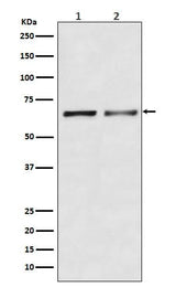 Anti-Activin Receptor Type IIB/ACVR2B Rabbit Monoclonal Antibody Boster Bio