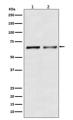 Anti-Activin Receptor Type IIB/ACVR2B Rabbit Monoclonal Antibody Boster Bio