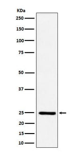 Anti-Ephrin A1 Rabbit Monoclonal Antibody Boster Bio