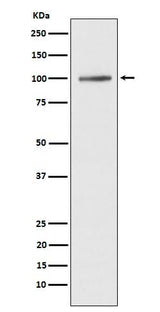 Anti-ATP2A1/SERCA1 Rabbit Monoclonal Antibody Boster Bio