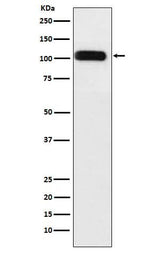 Anti-SERCA1 ATPase Rabbit Monoclonal Antibody Boster Bio