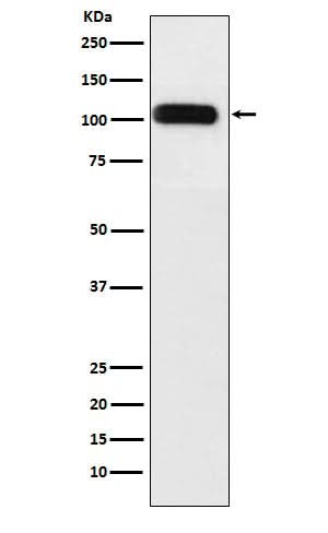 Anti-SERCA1 ATPase Rabbit Monoclonal Antibody Boster Bio