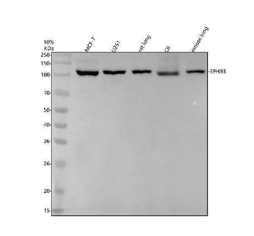 Anti-Eph receptor B3 Rabbit Monoclonal Antibody Boster Bio